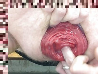 Gay guy pushes out and shows off giant rosebud prolapse - CLOSEUP