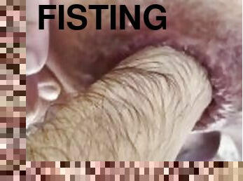 extrem, fisting, anal, hardcore, gay, pula