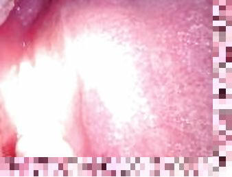 Inside my mouth (with braces)